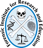 Human Remains Found On Monday Are Male