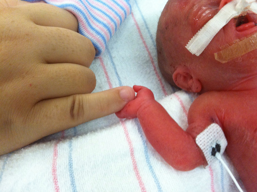 Slight Setback in Tennessee as Premature Births Rise