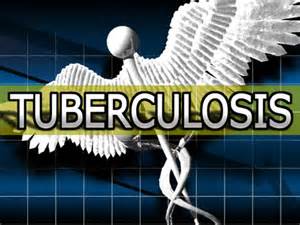 Smyrna Student Has Tuberculosis, Several Others To Be Tested