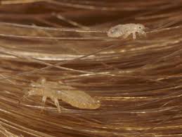 New Form of Lice Appearing in Tennessee