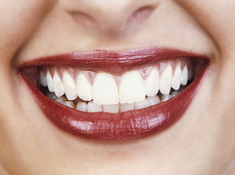3D Printer can make Braces for Teeth